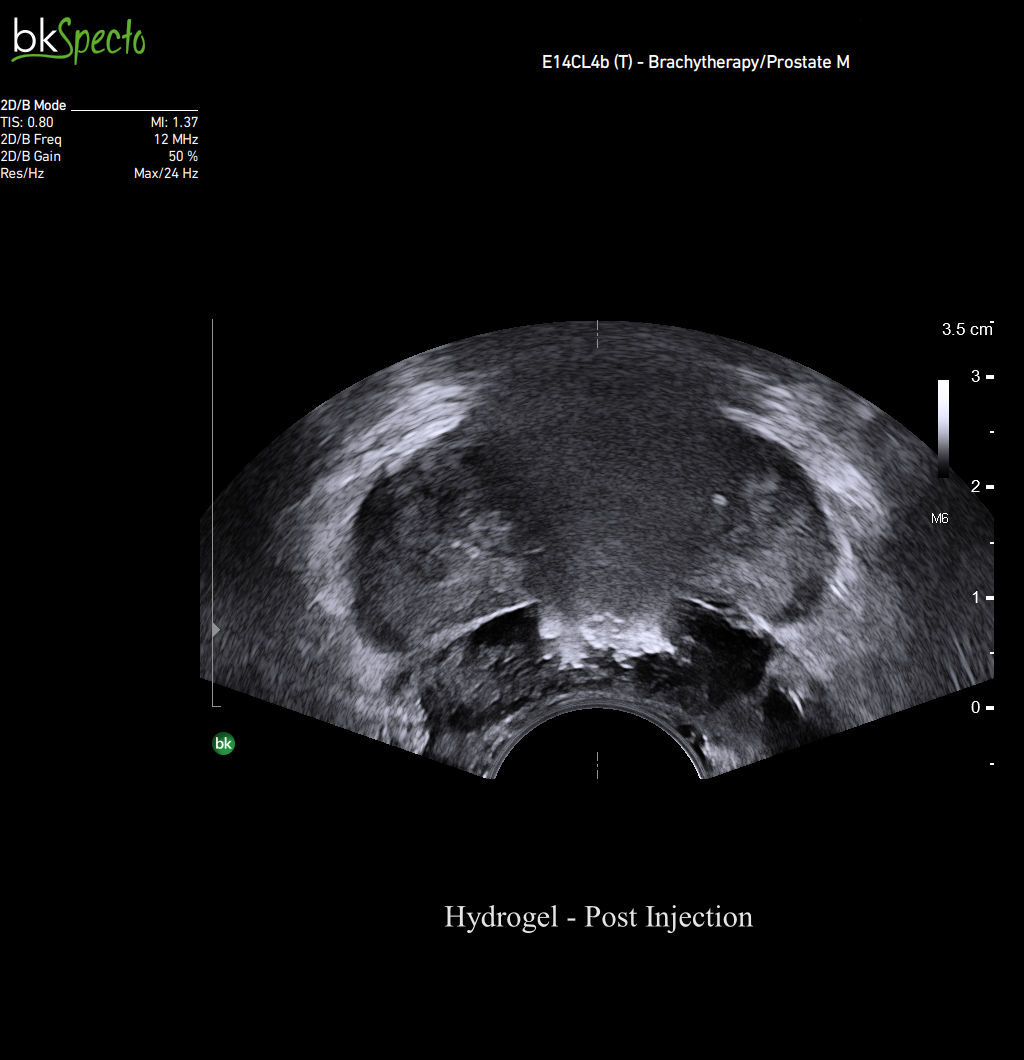 9048_hydrogel trv1_8