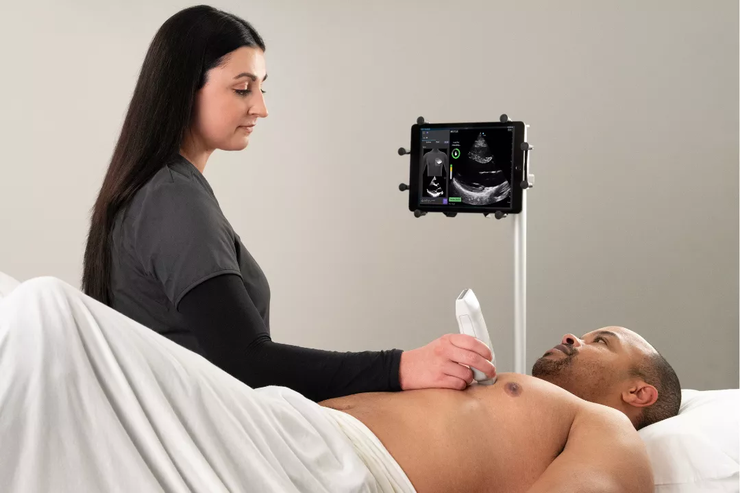 AI_guided_ultrasound