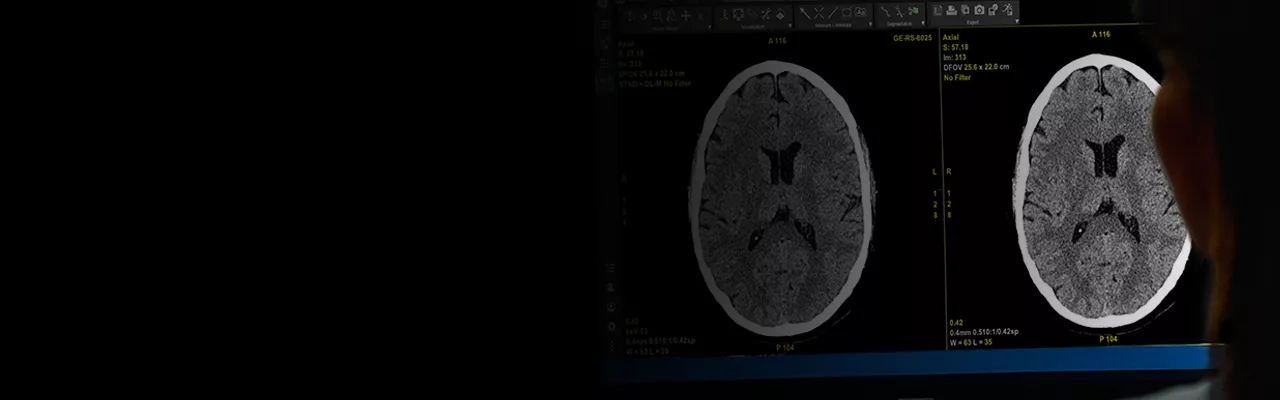Banner-Photon-Counting-CT-Category-Page