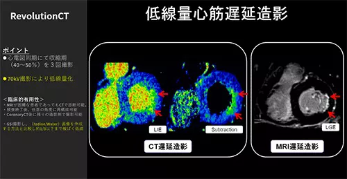 Cardiovascular_01_01