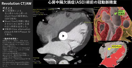 Cardiovascular_03_01