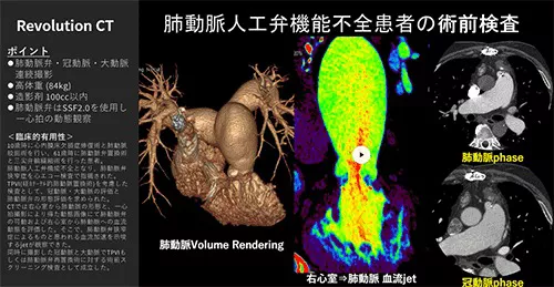 Cardiovascular_04_01