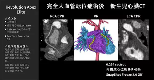 Cardiovascular_05_01