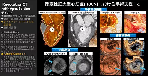 Cardiovascular_06_01