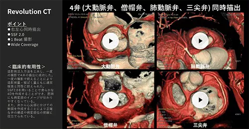 Cardiovascular_08_01
