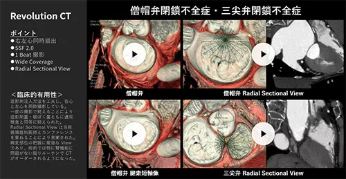 Cardiovascular_09_01