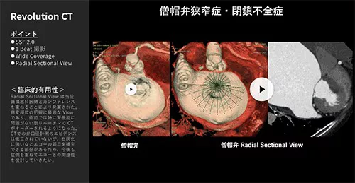 Cardiovascular_10_01