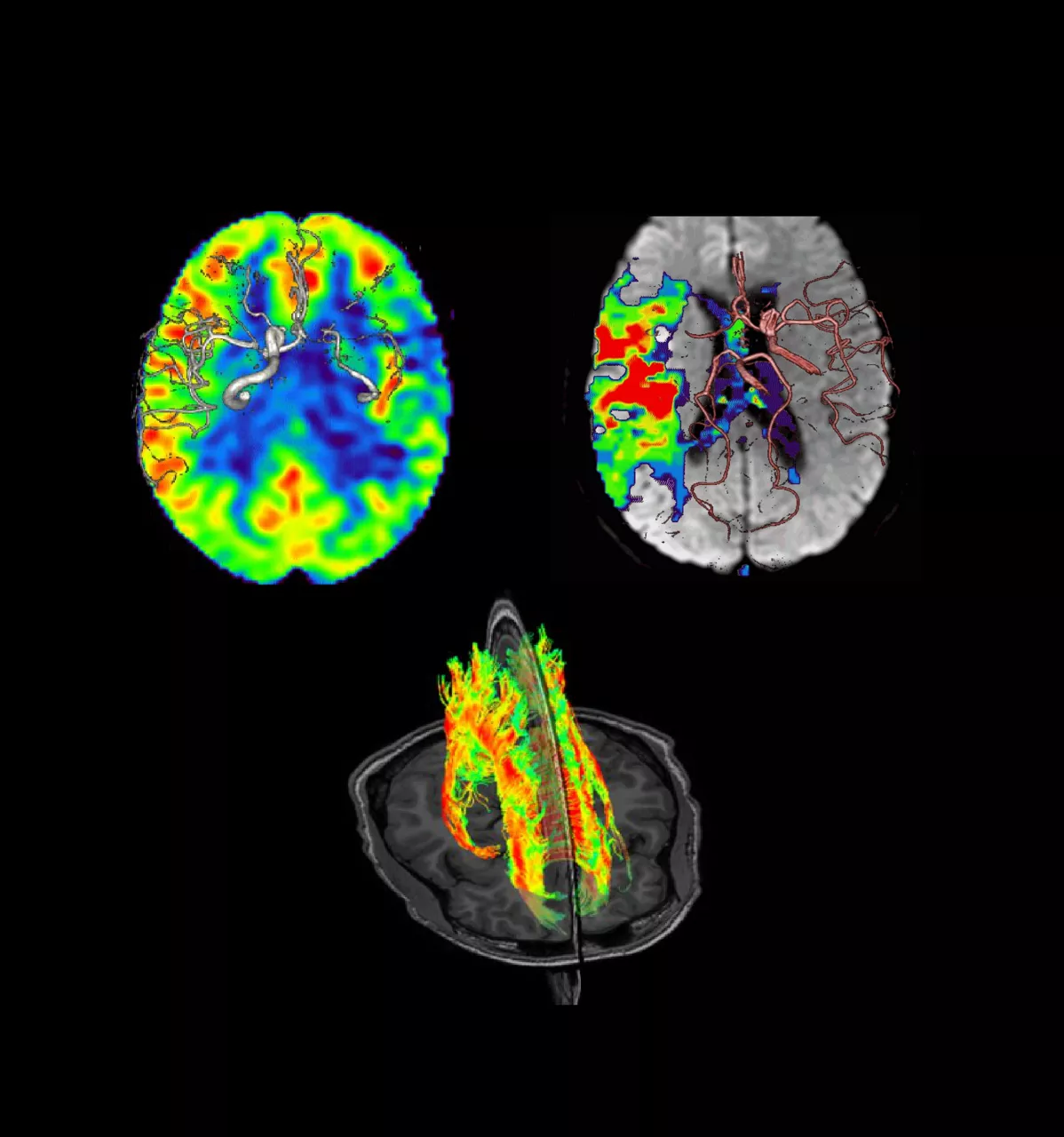 Feature-Hero-1-Brain-view-ci-en