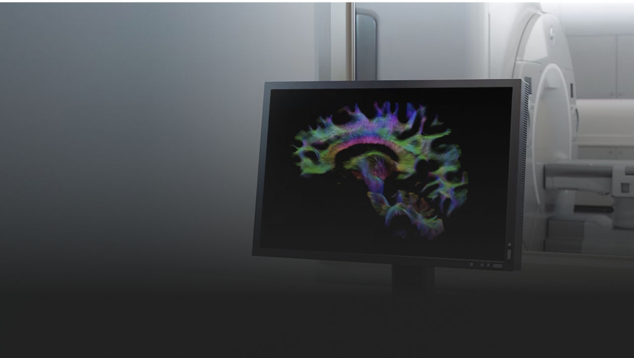 content card image