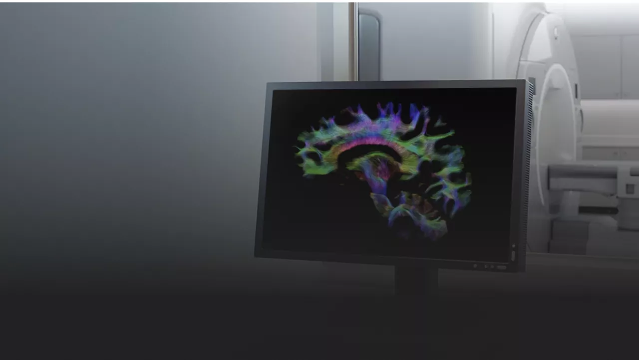 content card image