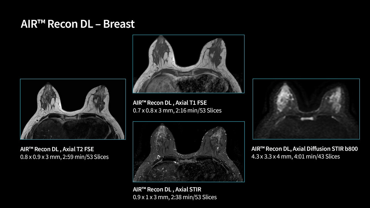 SIGNA Victor 1.5T clinical images | GE HealthCare (United States)