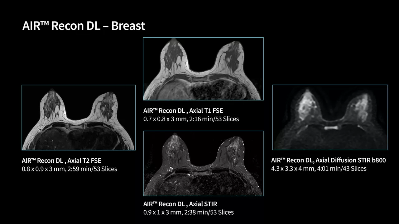 SIGNA Victor 1.5T clinical images | GE HealthCare (United States)