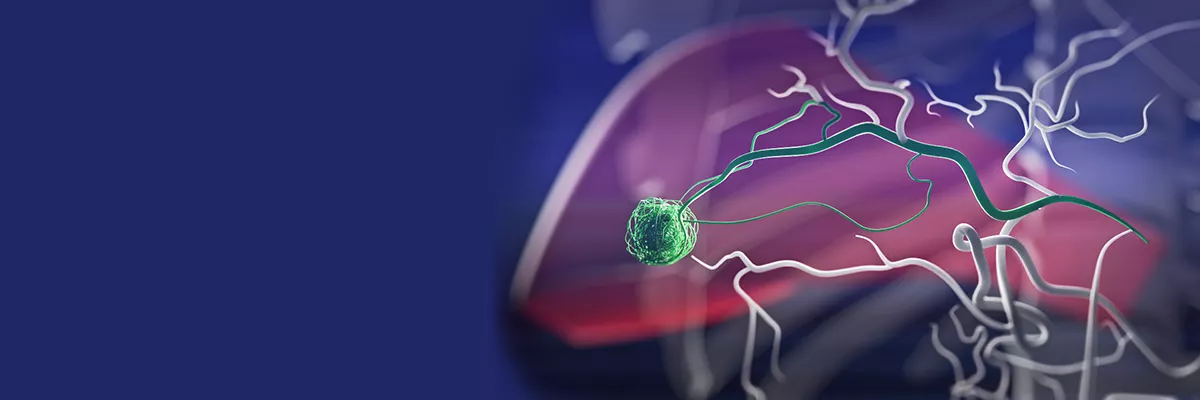 Interventional-flightplan-for-liver-hero (1)