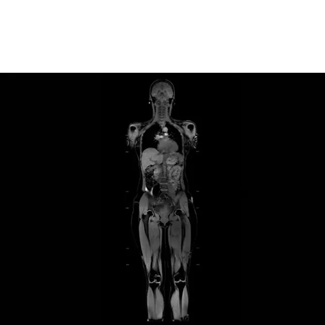 MR-Applications-body