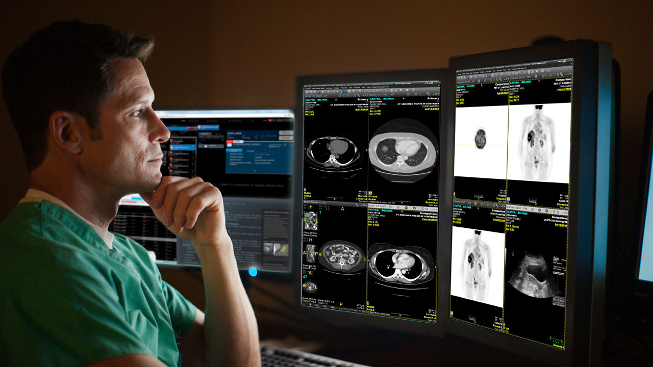 Pace-balance-leveraging-new-ba-en