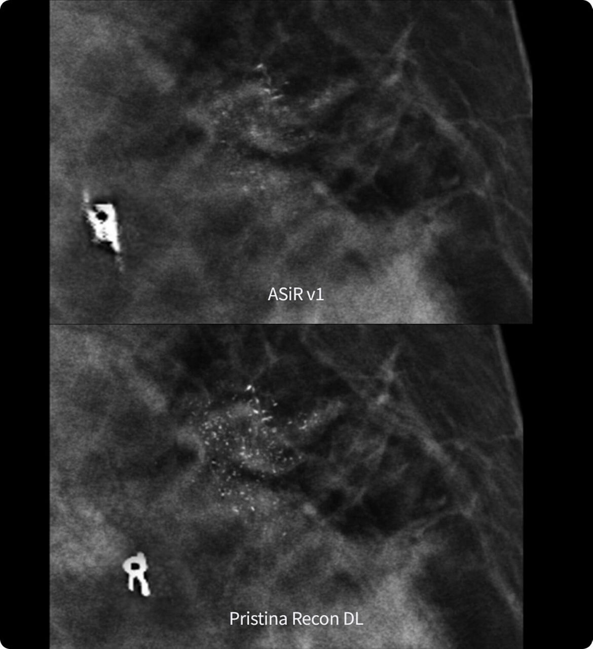 PristinaReconDL-FeatureHero2
