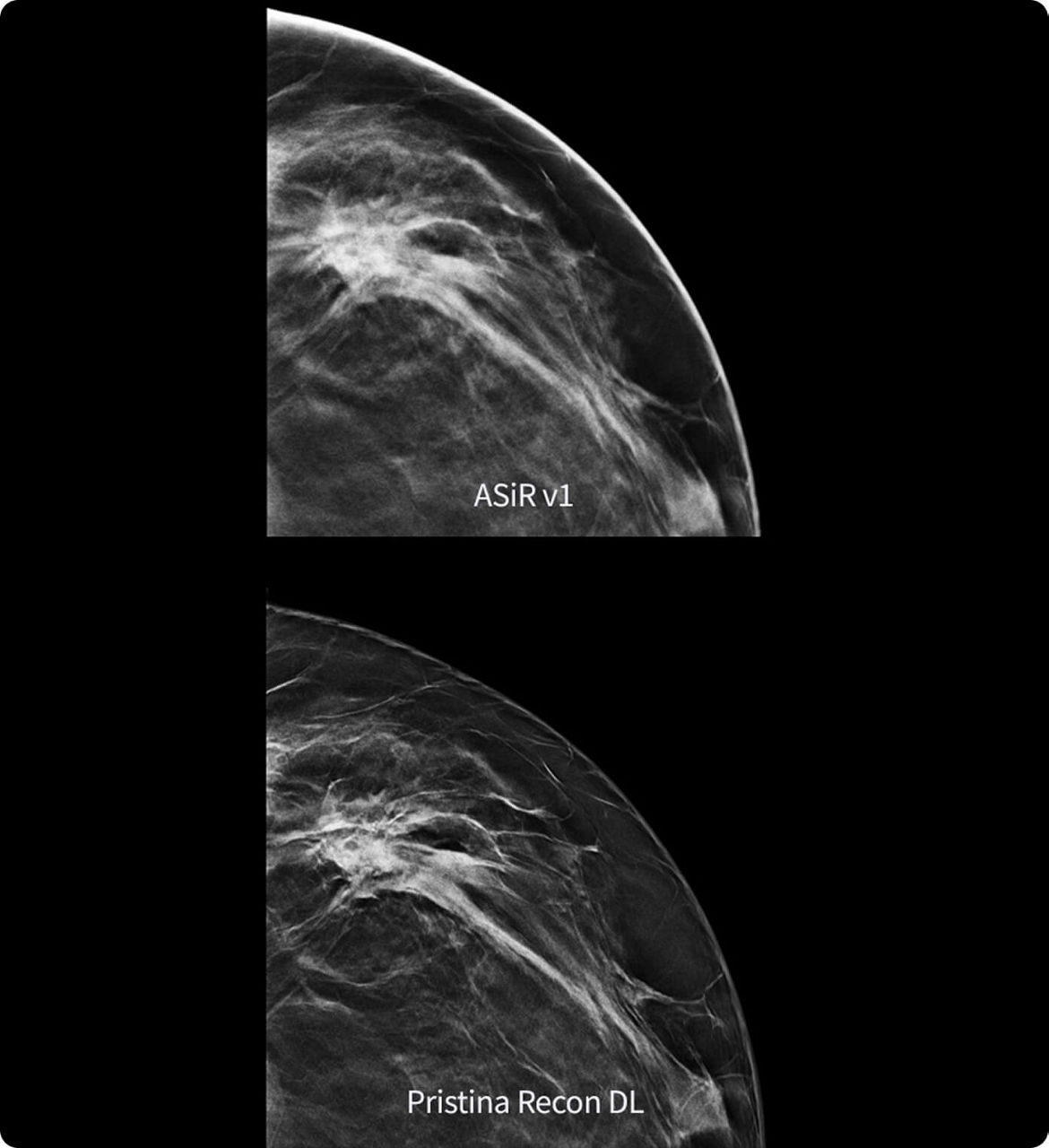 PristinaReconDL-FeatureHero3