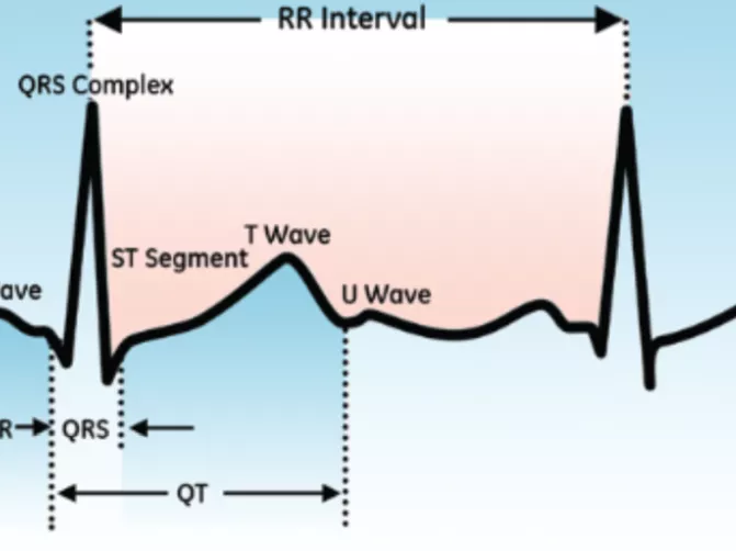 QT_Interval