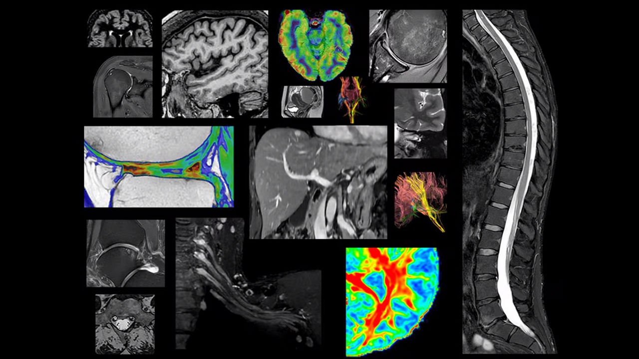SIGNA-Continuum-Legacy-MRI-Software updates switcher desktop