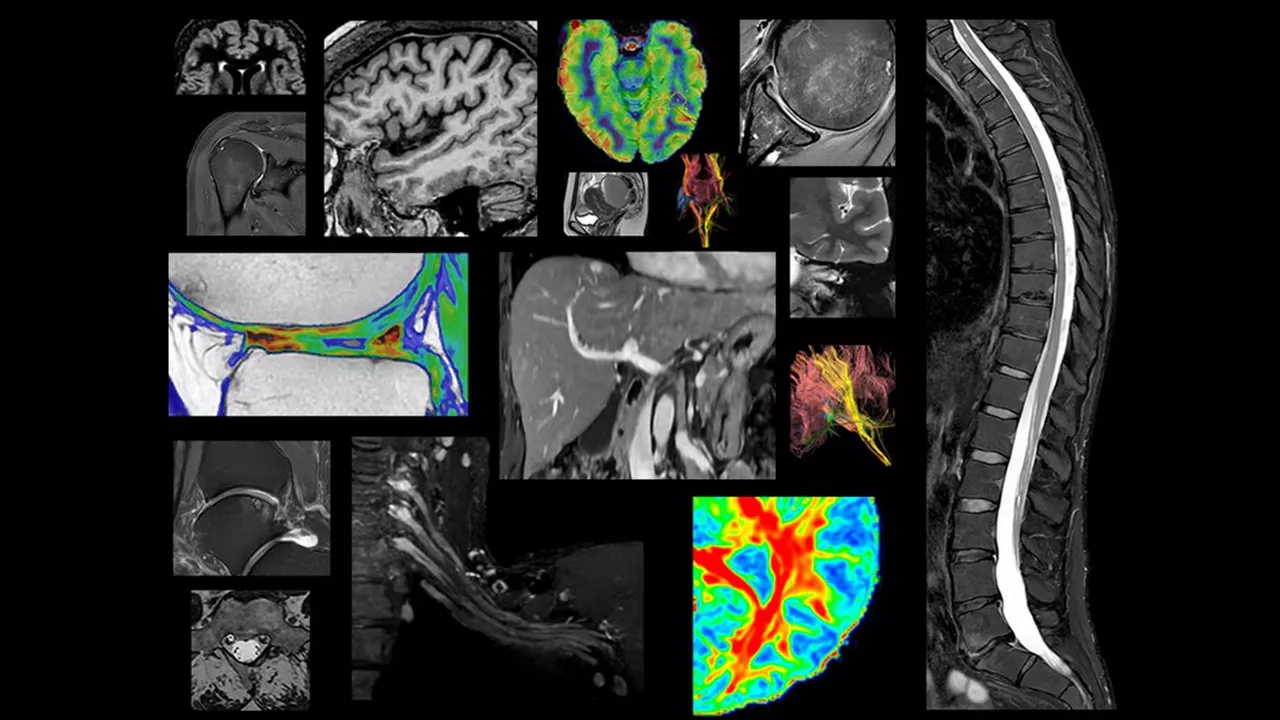SIGNA-Continuum-Legacy-MRI-Software updates switcher desktop