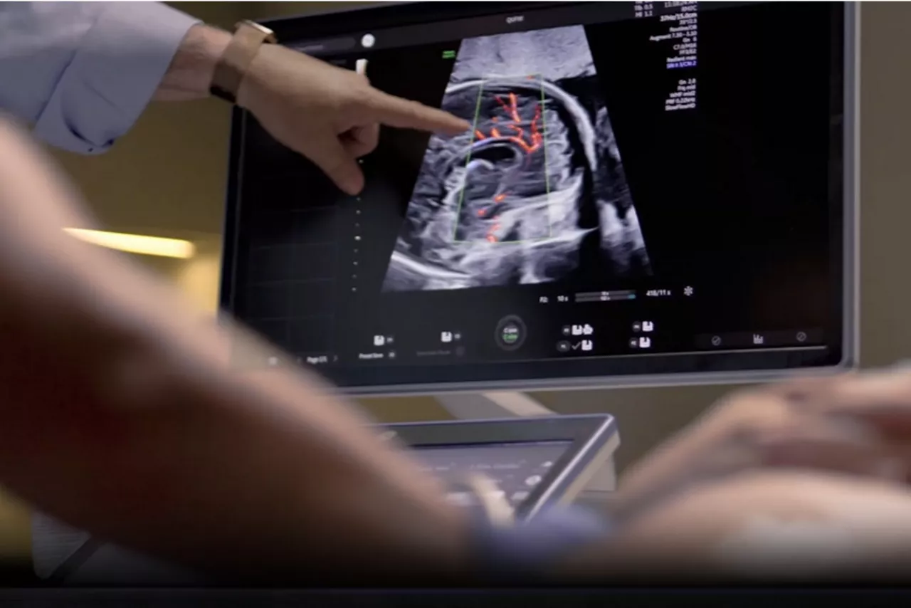 Ultrasound Collaboration