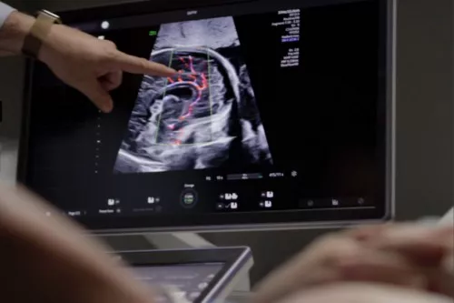 Ultrasound_AI