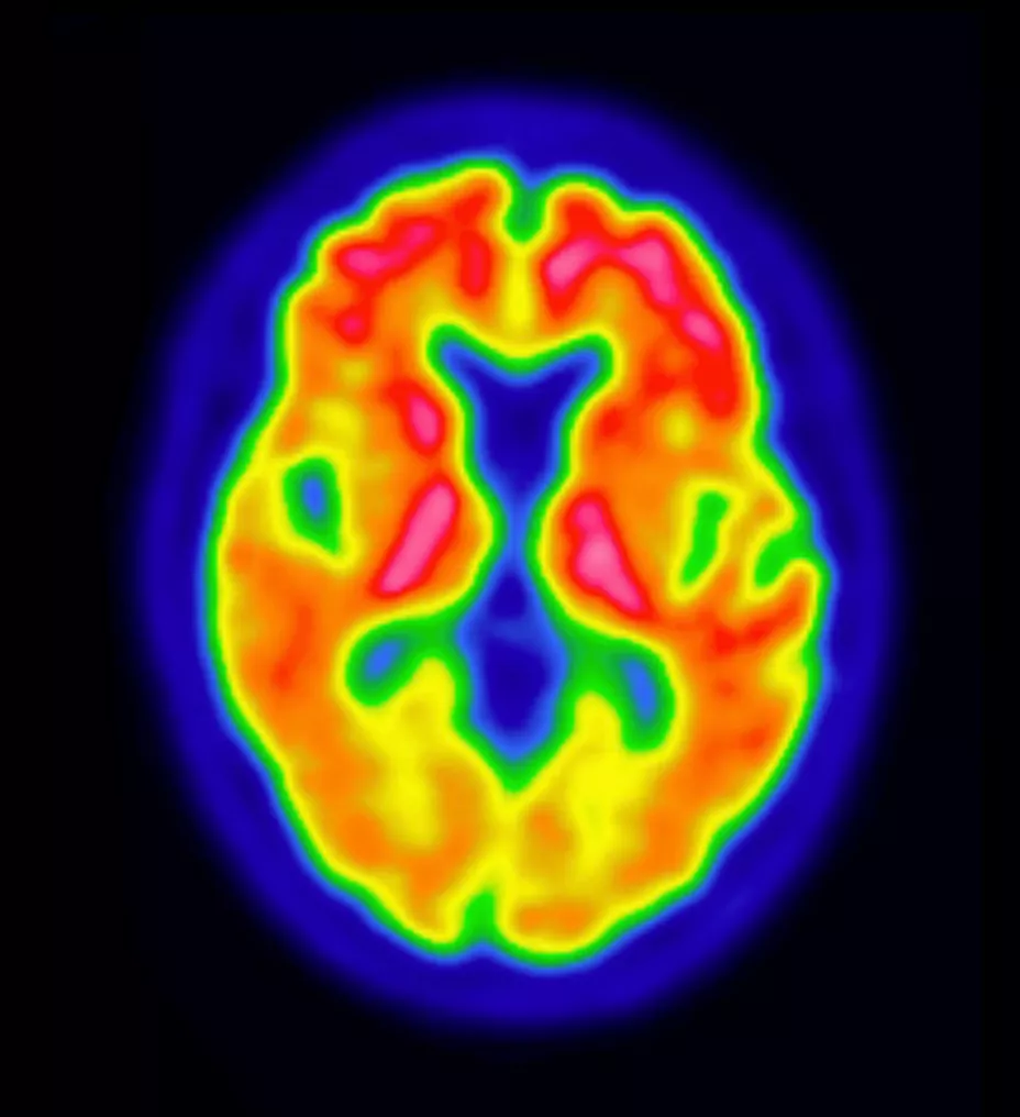 Vizamyl-Brain-Destop-928x1016