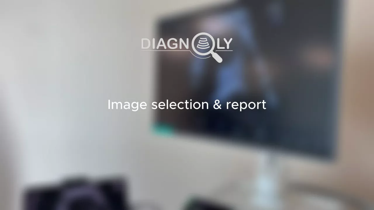 Voluson-solution-store-fetoly-real-time-ai-image-selection-reporting
