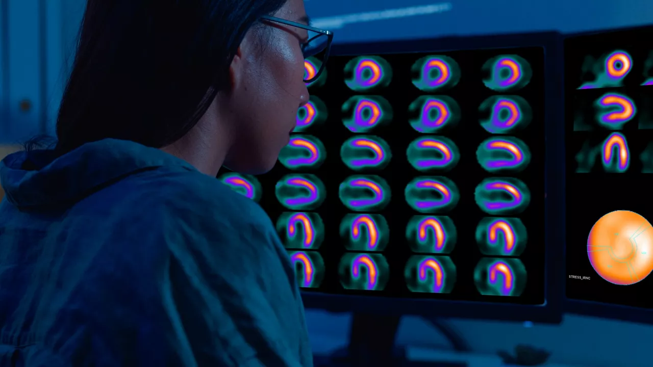 Woman looking at a cardiac PET scan