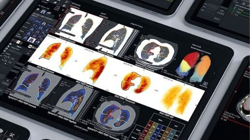 Xeleris-V-Molecular-Imaging-feature-card-01