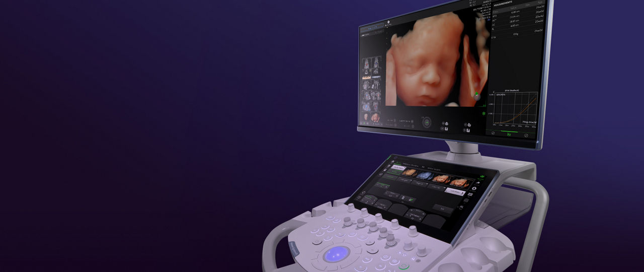 _voluson-signature-20