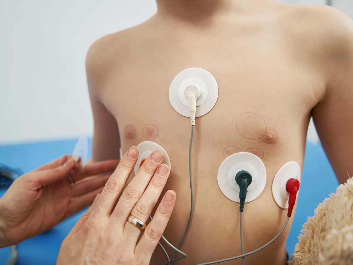 a-child-gets-a-holter-ecg-to-check-for-an-arrhythmia