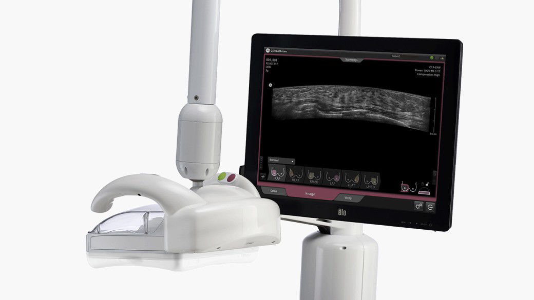 abus-breast-imaging-mobile