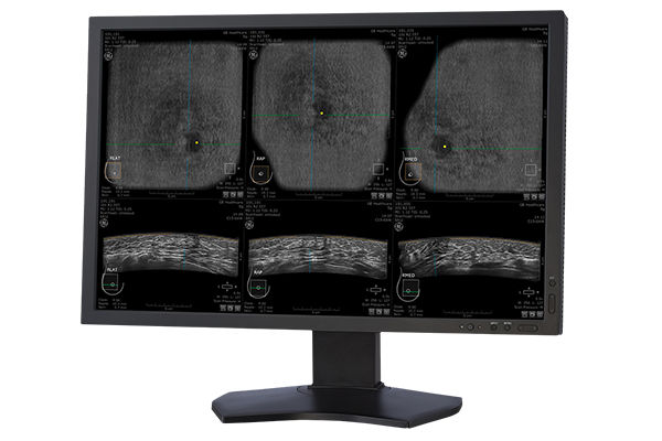 ABUS Clinical Evidence