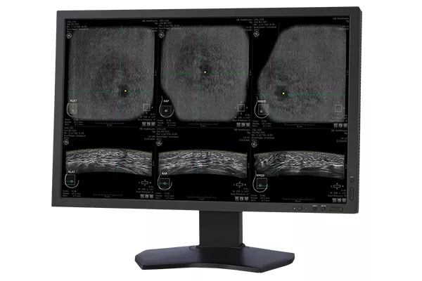 ABUS Clinical Evidence