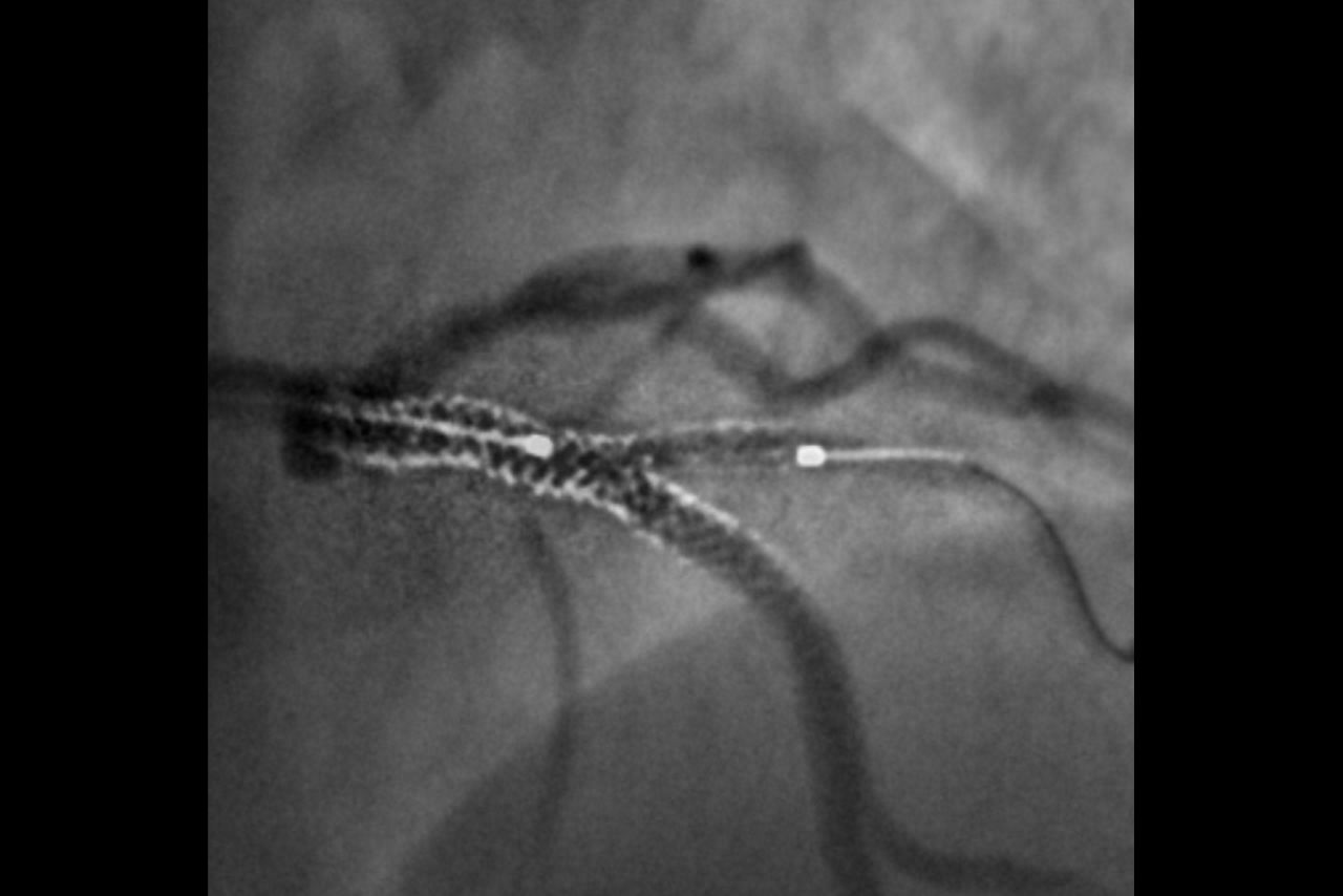 access-desktop3-greater-precisionci-en