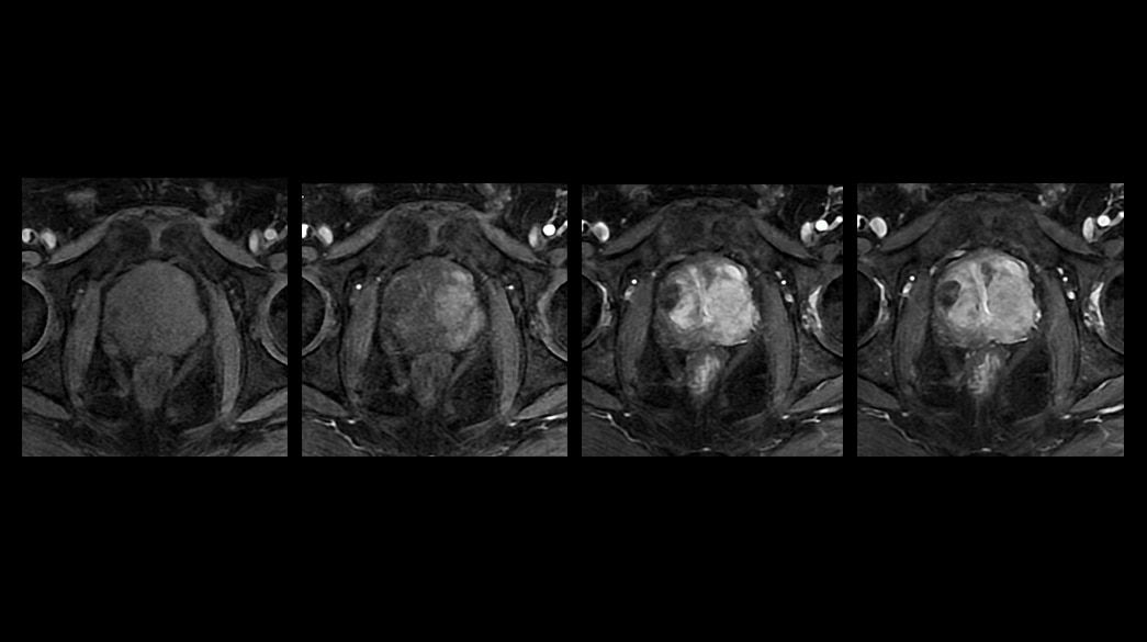 <p>DISCO &amp; DISCO Flex</p>
