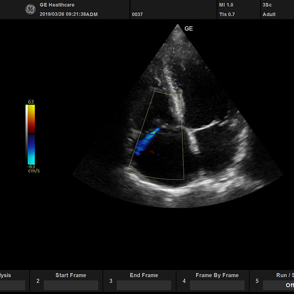 active_3Sc_cardiac_color_TR_595x595