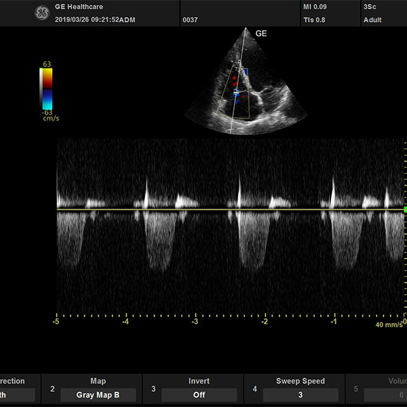 active_3Sc_cardiac_CWTR_595x595