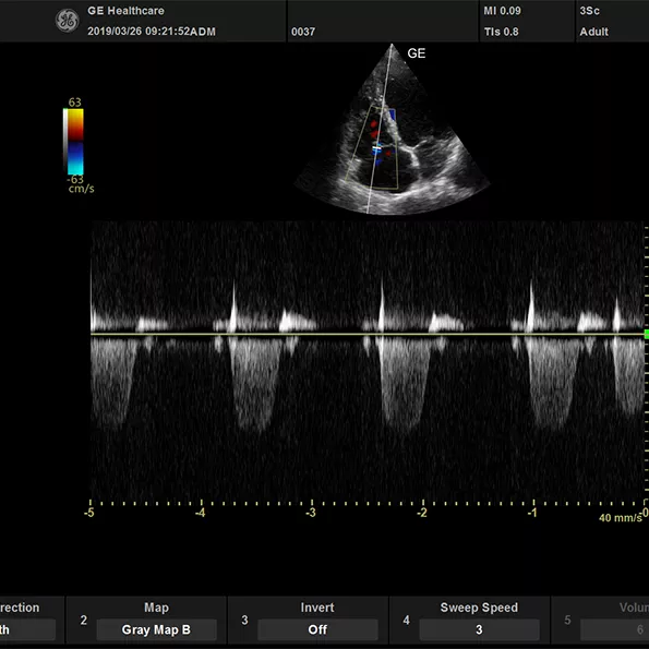 active_3Sc_cardiac_CWTR_595x595