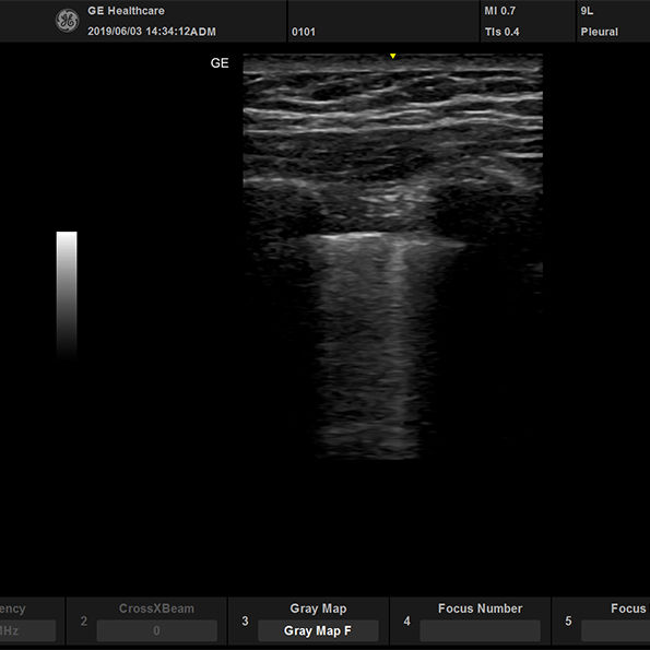 active_9L_lung_595x595