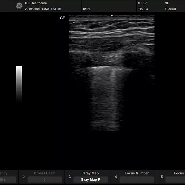 active_9L_lung_595x595