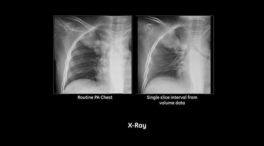 Advanced-Applications_Xray-carouse