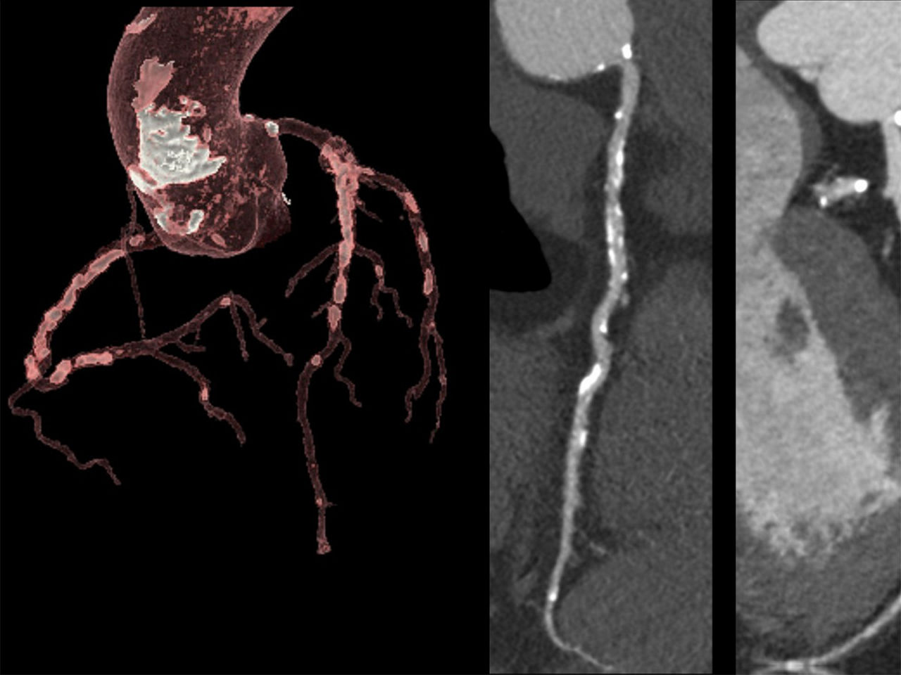 advanced-cardiac-ct-care-ArticleHero-ci-en
