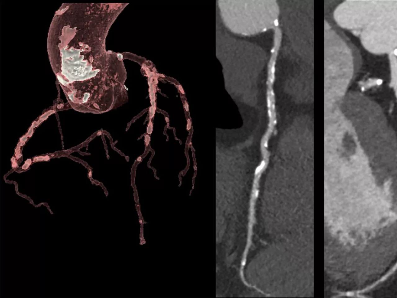 advanced-cardiac-ct-care-ArticleHero-ci-en