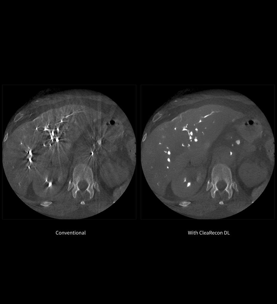 advanced-cbct3
