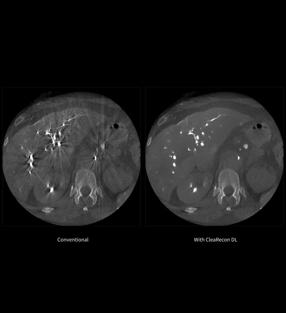 advanced-cbct3