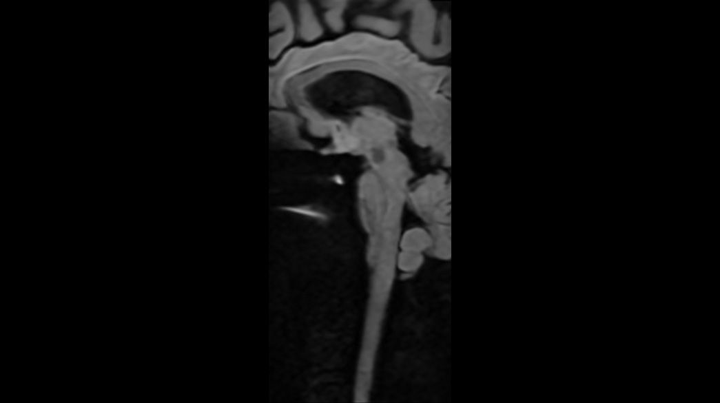 Advanced-DWI1040-x-585