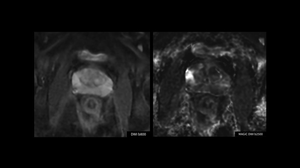 Advanced-DWI1040-x-585