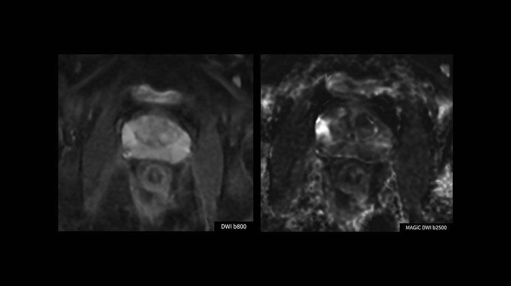 Advanced-DWI1040-x-585